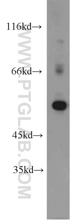 ALDH1A2 Rabbit anti-Human, Mouse, Rat, Polyclonal, Proteintech 150 &mu;L;