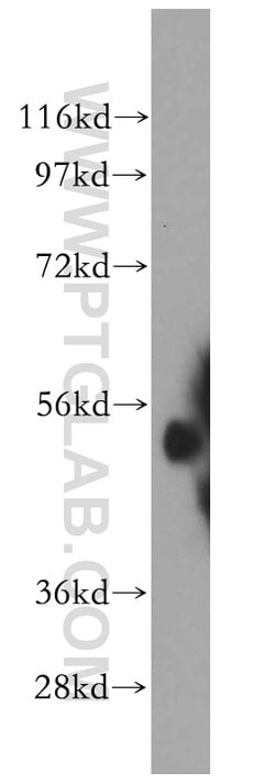 ALDH1A2 Rabbit anti-Human, Mouse, Rat, Polyclonal, Proteintech 150 &mu;L;