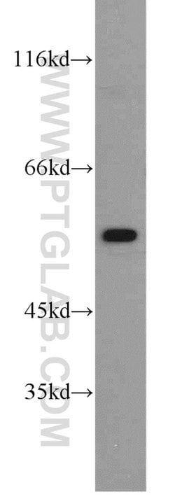 ALDH1A2 Rabbit anti-Human, Mouse, Rat, Polyclonal, Proteintech 150 &mu;L;