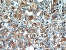 CD43 Rabbit anti-Human, Polyclonal, Proteintech 150 &mu;L; Unconjugated:Antibodies,