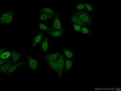 PPFIBP1 Rabbit anti-Human, Mouse, Rat, Polyclonal, Proteintech:Antibodies:Primary