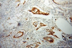 PPFIBP1 Rabbit anti-Human, Mouse, Rat, Polyclonal, Proteintech:Antibodies:Primary