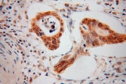 PPFIBP1 Rabbit anti-Human, Mouse, Rat, Polyclonal, Proteintech:Antibodies:Primary