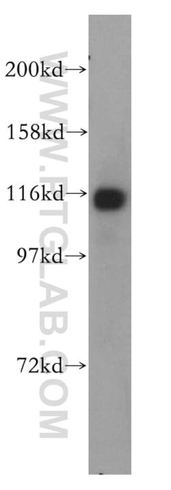 PPFIBP1 Rabbit anti-Human, Mouse, Rat, Polyclonal, Proteintech:Antibodies:Primary