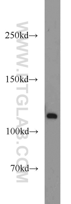 PPFIBP1 Rabbit anti-Human, Mouse, Rat, Polyclonal, Proteintech:Antibodies:Primary