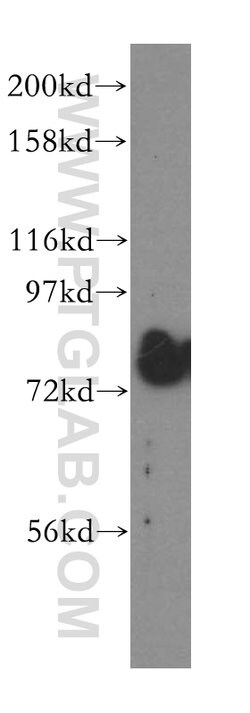 GALNT7 Rabbit anti-Human, Mouse, Rat, Polyclonal, Proteintech:Antibodies:Primary