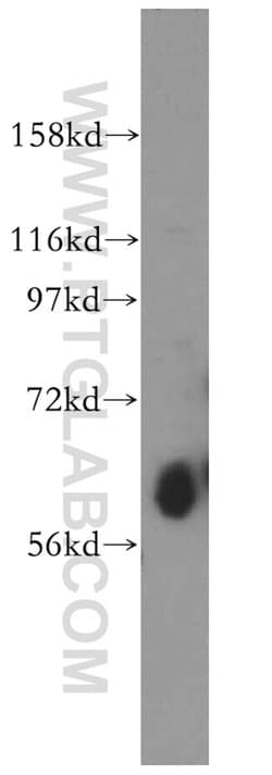 ZnT7 Rabbit anti-Human, Mouse, Rat, Polyclonal, Proteintech:Antibodies:Primary