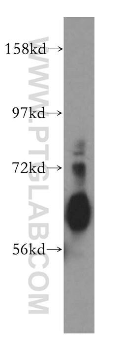 ZnT7 Rabbit anti-Human, Mouse, Rat, Polyclonal, Proteintech:Antibodies:Primary