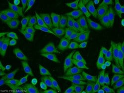 HSPA1L Rabbit anti-Human, Mouse, Rat, Polyclonal, Proteintech 150 &mu;L;