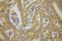 HSPA1L Rabbit anti-Human, Mouse, Rat, Polyclonal, Proteintech 150 &mu;L;