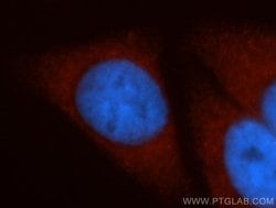 HSPA1L Rabbit anti-Human, Mouse, Rat, Polyclonal, Proteintech 150 &mu;L;