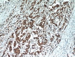 HSPA1L Rabbit anti-Human, Mouse, Rat, Polyclonal, Proteintech 150 &mu;L;
