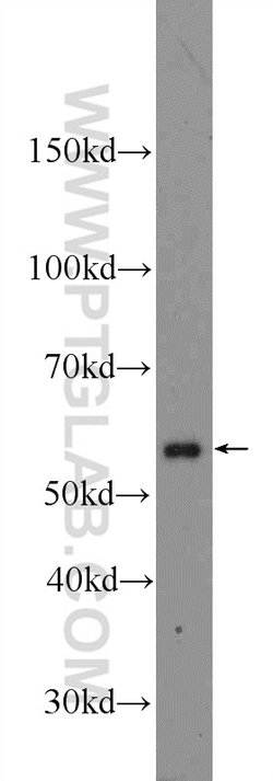 Calicin Rabbit anti-Human, Mouse, Rat, Polyclonal, Proteintech:Antibodies:Primary