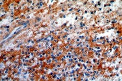 CNNM3 Rabbit anti-Human, Mouse, Rat, Polyclonal, Proteintech 150 &mu;L;