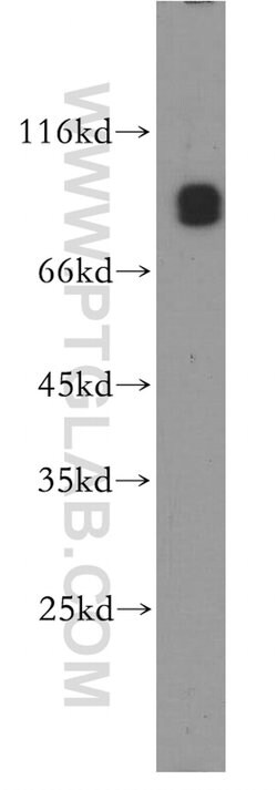 CNNM3 Rabbit anti-Human, Mouse, Rat, Polyclonal, Proteintech 150 &mu;L;