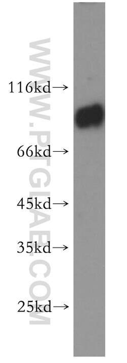 CNNM3 Rabbit anti-Human, Mouse, Rat, Polyclonal, Proteintech 150 &mu;L;