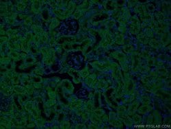 SEC63 Rabbit anti-Human, Mouse, Rat, Polyclonal, Proteintech:Antibodies:Primary