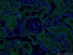 SEC63 Rabbit anti-Human, Mouse, Rat, Polyclonal, Proteintech:Antibodies:Primary