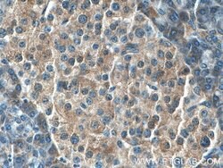 SEC63 Rabbit anti-Human, Mouse, Rat, Polyclonal, Proteintech:Antibodies:Primary