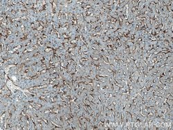 Proteintech SEC63 Rabbit anti-Human, Mouse, Rat, Polyclonal, Proteintech