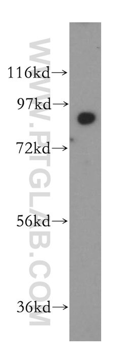 SEC63 Rabbit anti-Human, Mouse, Rat, Polyclonal, Proteintech:Antibodies:Primary