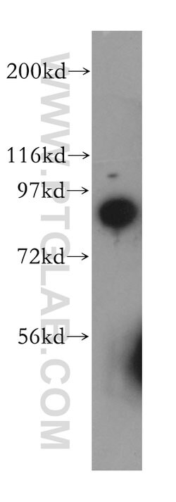 SEC63 Rabbit anti-Human, Mouse, Rat, Polyclonal, Proteintech:Antibodies:Primary