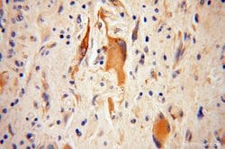 ANGPTL5 Rabbit anti-Human, Polyclonal, Proteintech:Antibodies:Primary Antibodies