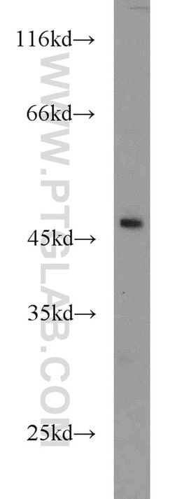 ANGPTL5 Rabbit anti-Human, Polyclonal, Proteintech:Antibodies:Primary Antibodies