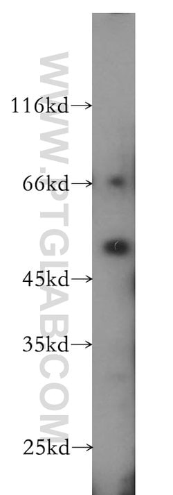 PARD6B Rabbit anti-Human, Mouse, Rat, Polyclonal, Proteintech 150 &mu;L;