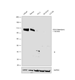 CD10 Monoclonal Antibody (eBioCB-CALLA (CB-CALLA)), eBioscience:Antibodies,