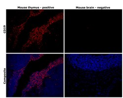 Invitrogen CD19 Monoclonal Antibody (LC1), eBioscience:Antibodies:Primary