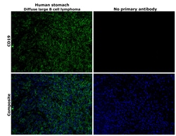 Invitrogen CD19 Monoclonal Antibody (6OMP31), eBioscience , Invitrogen