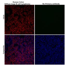 CD20 Monoclonal Antibody (L26), eBioscience , Invitrogen:Antibodies:Primary