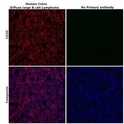 CD20 Monoclonal Antibody (L26), eBioscience , Invitrogen:Antibodies:Primary