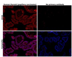 Invitrogen CD39 Monoclonal Antibody (eBioA1 (A1)), eBioscience , Invitrogen