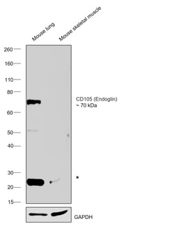 Invitrogen CD105 (Endoglin) Monoclonal Antibody (MJ7/18), eBioscience ,