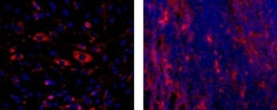 Invitrogen CD141 Monoclonal Antibody (LS17-9), eBioscience 100 &mu;g; Unconjugated:Antibodies,