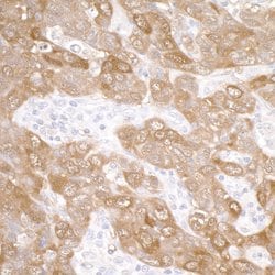 14-3-3 Sigma Rabbit anti-Human, Polyclonal, Bethyl Laboratories 100 &mu;L;