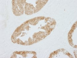 14-3-3 Sigma Polyclonal Antibody, Bethyl Laboratories 100 &mu;L; Unconjugated:Antibodies,
