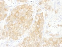 14-3-3 theta Rabbit anti-Human, Polyclonal, Bethyl Laboratories 10 &mu;L;