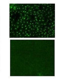 Rat IgG2a kappa Isotype Control (eBR2a), eBioscience , Invitrogen:Anticuerpos:Controles