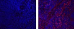 Rat IgG2a kappa Isotype Control (eBR2a), eBioscience , Invitrogen:Anticuerpos:Controles