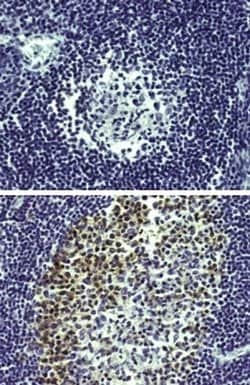 Rat IgG2a kappa Isotype Control (eBR2a), eBioscience , Invitrogen:Anticuerpos:Controles