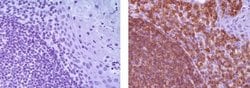 Rat IgG2a kappa Isotype Control (eBR2a), eBioscience , Invitrogen:Anticuerpos:Controles