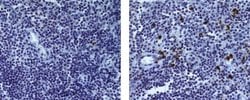 Rat IgG2a kappa Isotype Control (eBR2a), eBioscience , Invitrogen:Anticuerpos:Controles