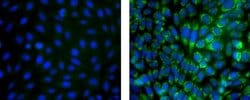 Mouse IgG1 kappa Isotype Control (P3.6.2.8.1), eBioscience , Invitrogen
