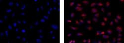 Mouse IgG1 kappa Isotype Control (P3.6.2.8.1), eBioscience , Invitrogen