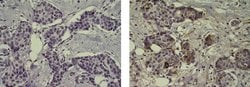 Mouse IgG1 kappa Isotype Control (P3.6.2.8.1), eBioscience , Invitrogen