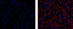 Mouse IgG1 kappa Isotype Control (P3.6.2.8.1), eBioscience , Invitrogen