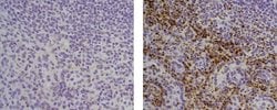 Mouse IgG1 kappa Isotype Control (P3.6.2.8.1), eBioscience , Invitrogen